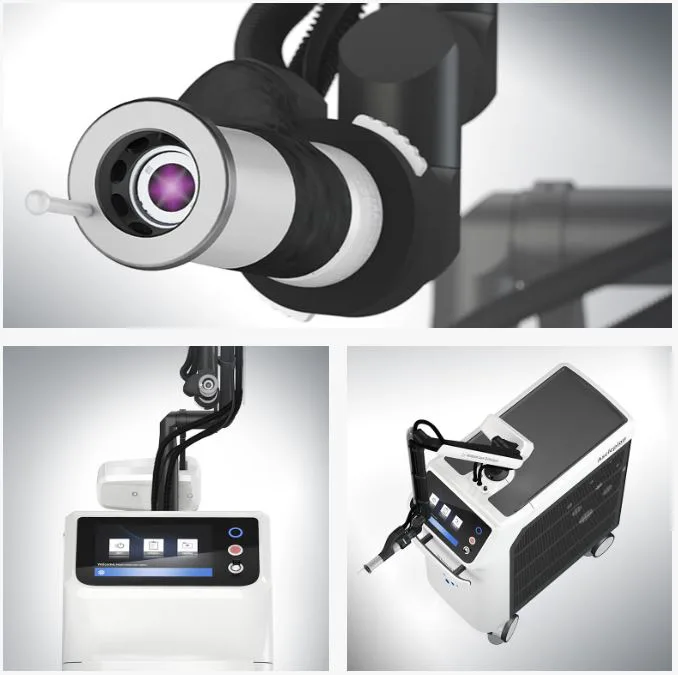 Chi tiết ngôn ngữ thiết kế Dermablate