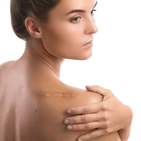 Trị liệu 3 - Trước